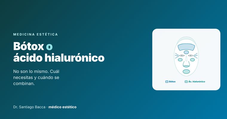 Bótox o ácido hialurónico: qué corrige cada uno